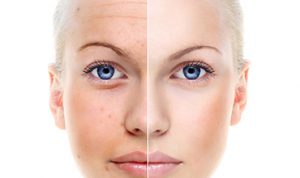 Chemical Peels - exfoliate and hydrate your skin. Innate Beauty - Cosmetic medicine and aesthetic procedures in Austin, Texas