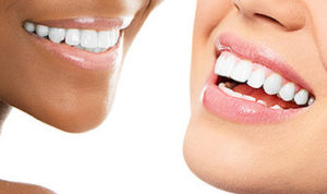 teeth_whitening_austin_1